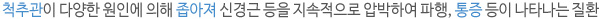 척추관이 다양한 원인에 의해 좁아져 신경근 등을 지속적으로 압박하여 파행, 통증 등이 나타나는 질환